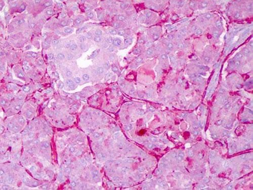 Polyclonal Rabbit anti-Human NOTCH1 Antibody (N-Terminus, IHC, WB)