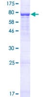 Human RTCB / C22orf28 Protein (Recombinant GST)