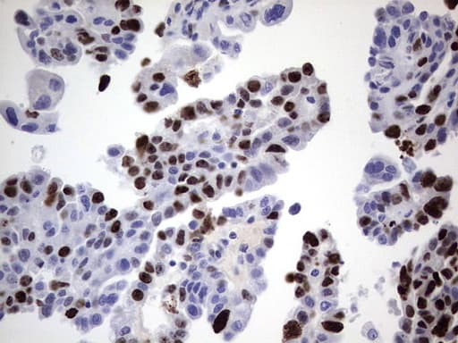 Monoclonal Rat anti-Human MKI67 / Ki67 Antibody (clone OTI3A11, aa1160-1493, IHC)