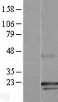 Human RABAC1 Protein (Over-Expression Lysate Myc-DDK (Flag))