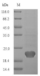 Human IL18 Protein (Recombinant 10His, N-terminus)