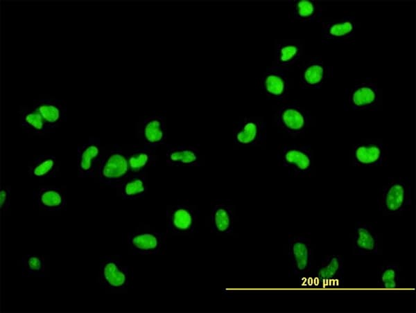 HMG2 / HMGB2 Antibody (clone 3E5)