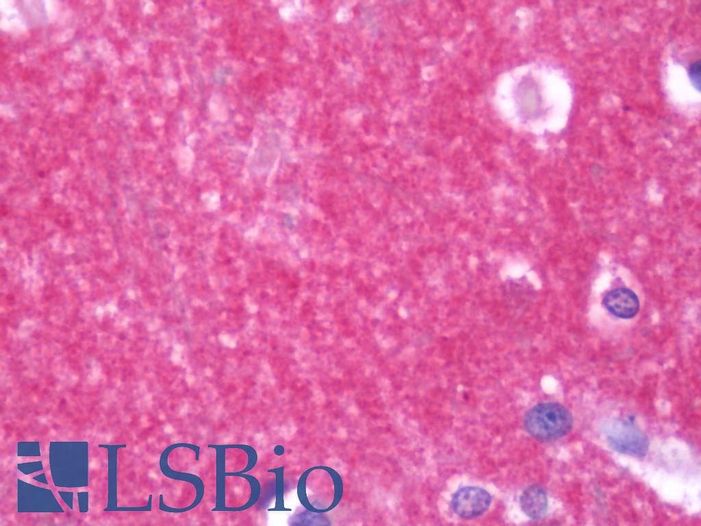 IHC-plus™ STAM1 / STAM Antibody (aa16-326)