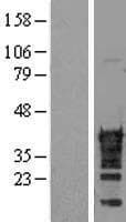 CDX2 Protein (Over-Expression Lysate Myc-DDK (Flag))