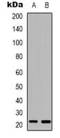 RAB37 Antibody (C-Terminus)