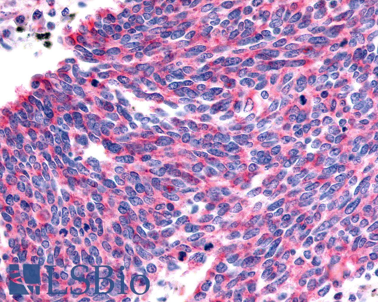 PathPlus™ ADGRG6 / GPR126 Antibody (C-Terminus)