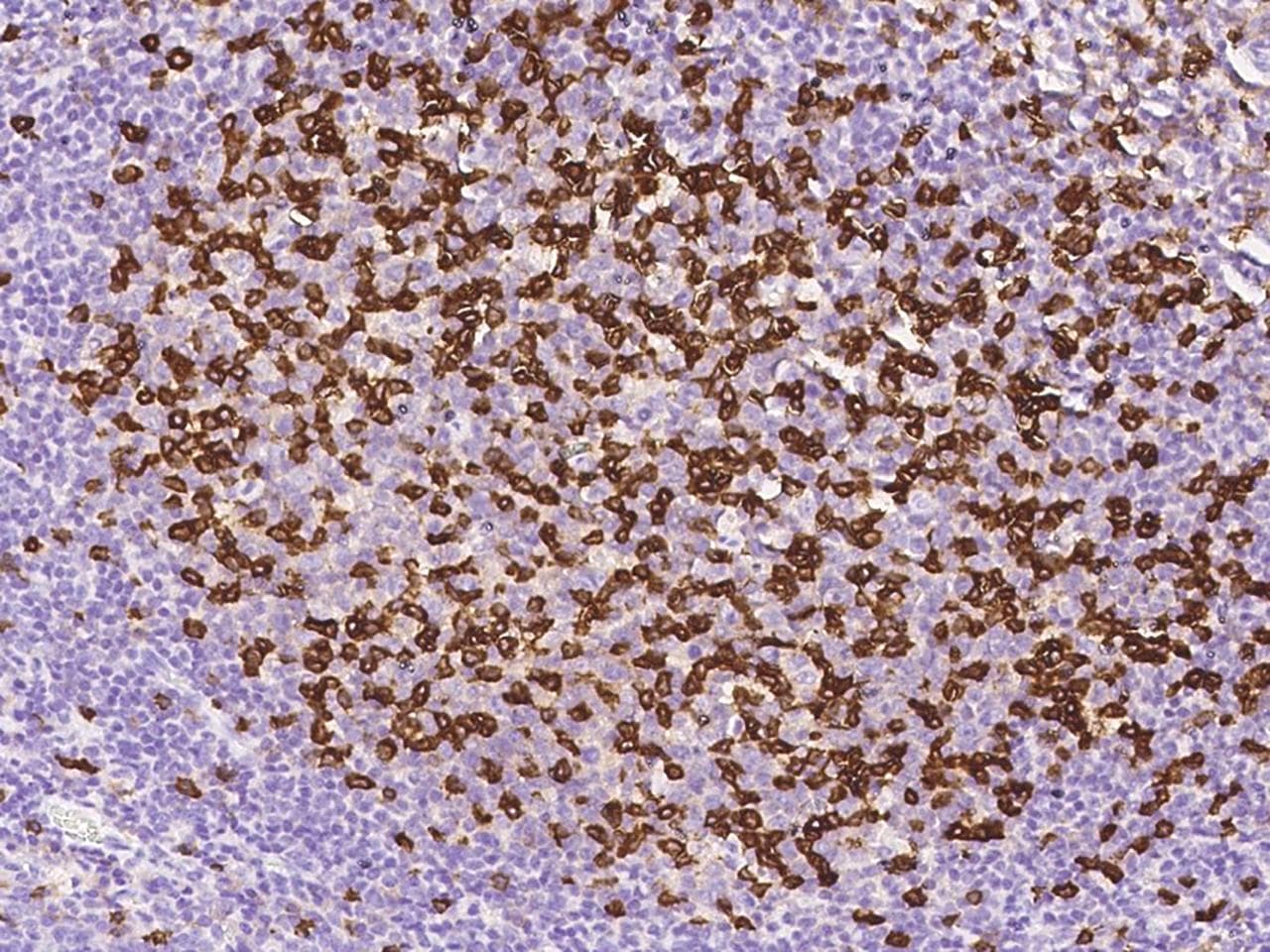 Monoclonal Mouse anti-Human PDCD1 / CD279 / PD-1 Antibody (clone 23, Preservative Free, IHC)