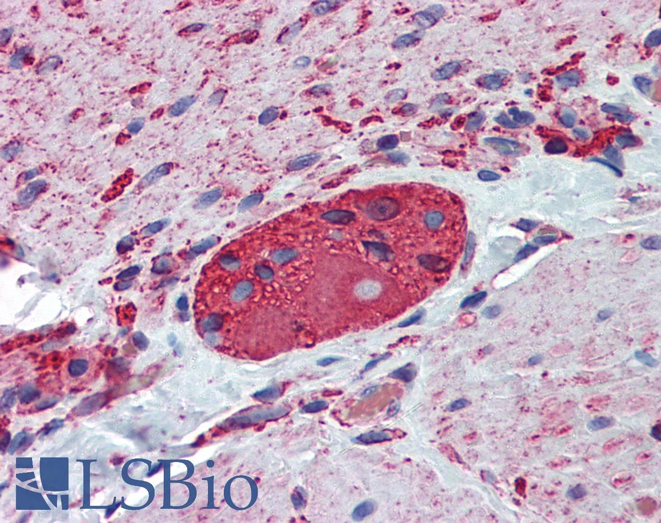 IHC-plus™ TUBB2A / Tubulin Beta 2A Antibody (clone 4B12)