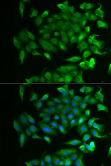 Polyclonal Rabbit anti-Human RBP2 / CRBPII Antibody (IHC, IF, WB)