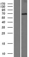 DTX2 Protein (Over-Expression Lysate Myc-DDK (Flag))