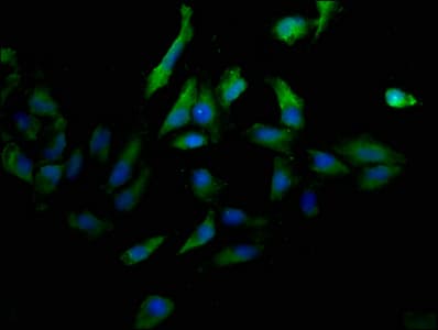 PECAM-1 / CD31 Antibody (clone 9E6E12)