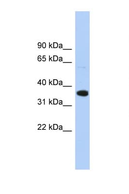 Polyclonal Rabbit anti-Human WNT2B Antibody (aa229-278, IHC, WB)