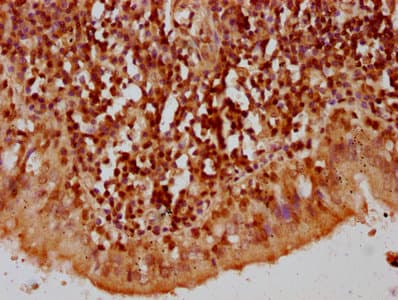HIST1H2AI Antibody