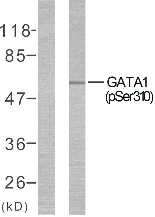 GATA1 Antibody (phospho-Ser310)