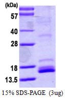 Human NTF4 / Neurotrophin 4 Protein (Recombinant)