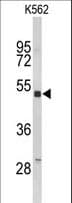 Polyclonal Rabbit anti-Human KIR3DL3 / CD158z Antibody (aa132-158, IHC, WB)