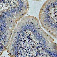 Polyclonal Rabbit anti-Human GOLM1 / GP73 / GOLPH2 Antibody (IHC, IF, WB)