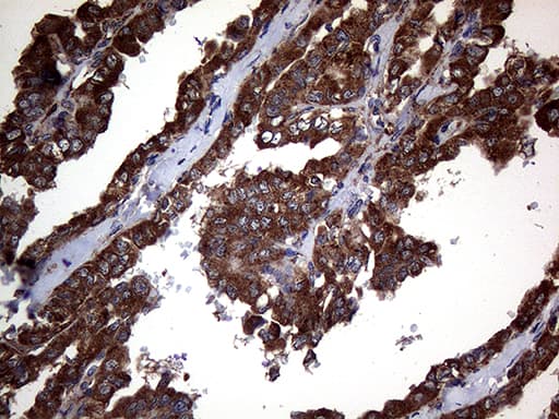 CTSL / Cathepsin L Antibody (clone OTI2F1)