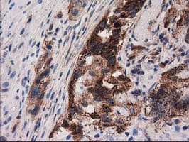 P5CR2 / PYCR2 Antibody (clone OTI2A12, Carrier-free)