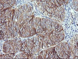 RALB Antibody (clone OTI2C4)
