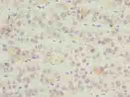 ZNF622 Antibody