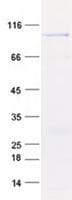 Human TTC30B Protein (Recombinant GST, N-terminus + His, C-terminus)