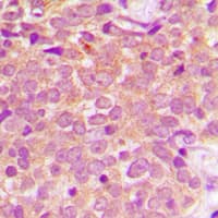 MAP2K1 / MKK1 / MEK1 Antibody (Internal)