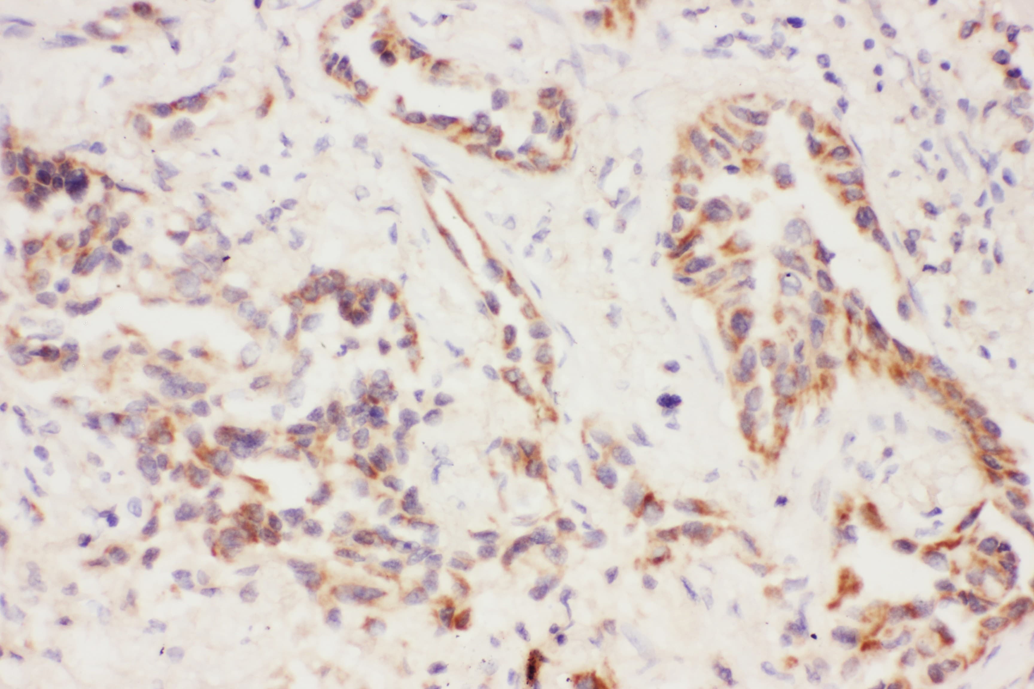 CCL26 / Eotaxin 3 Antibody (aa24-94)