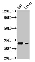 Polyclonal Rabbit anti-Human RHCG Antibody (IHC, WB)