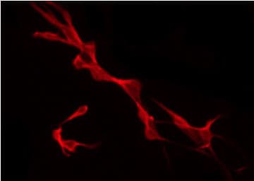CAMK2B / CaMKII Beta Antibody