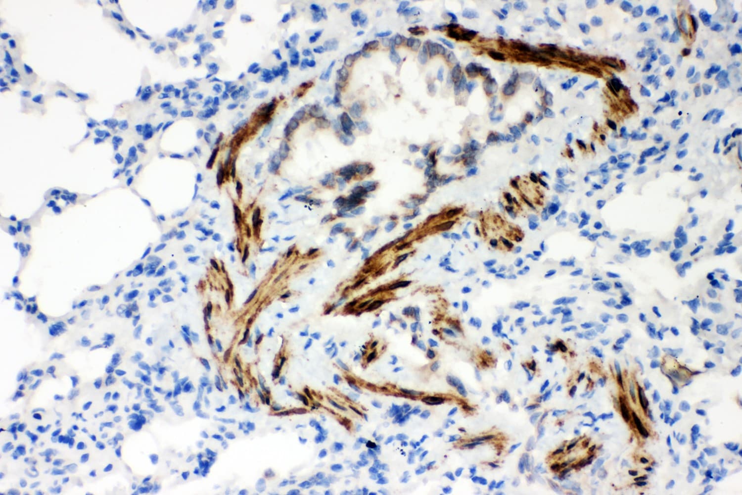 ATP2A2 / SERCA2 Antibody (aa1-32)