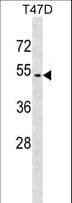 ZNF713 Antibody (aa122-149)
