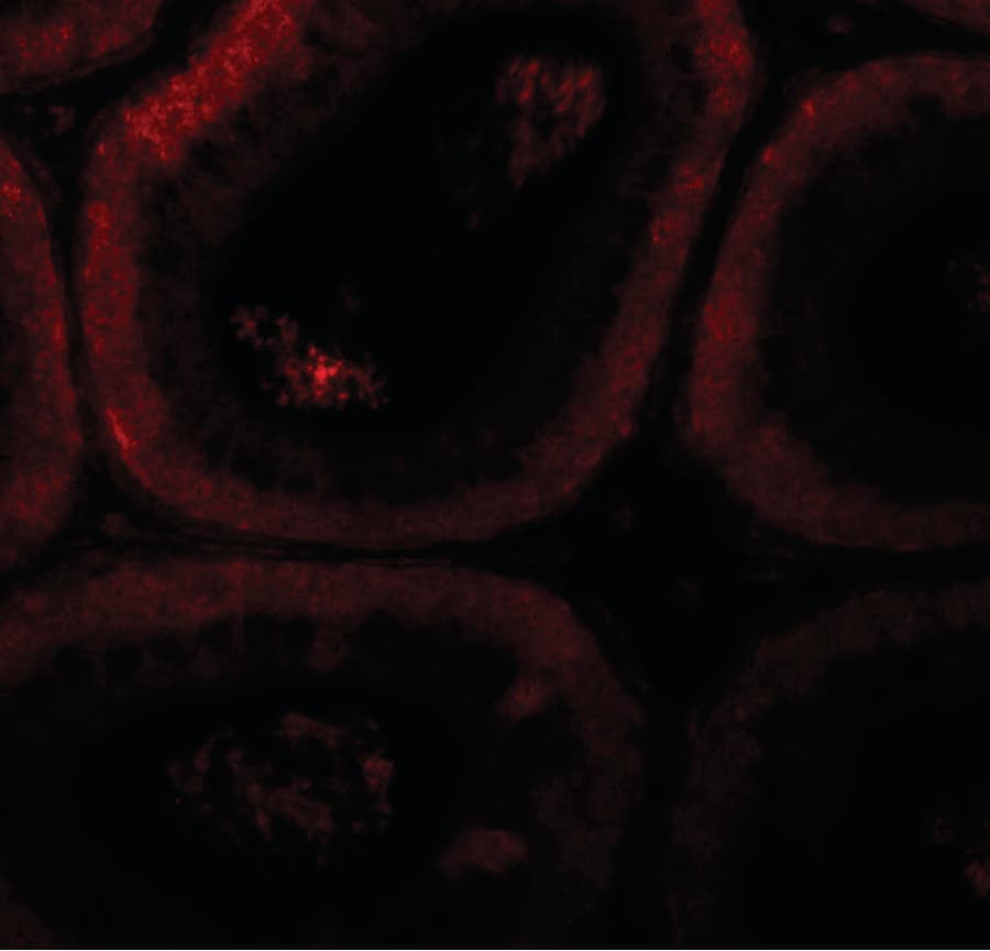SPATA3 / ASARG1 Antibody