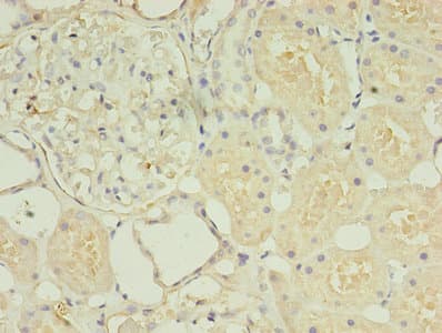 Polyclonal Rabbit anti-Human HOXA6 Antibody (IHC, WB)