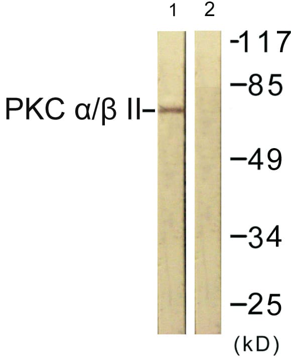 PRKCA / PKC-Alpha Antibody (aa606-655)