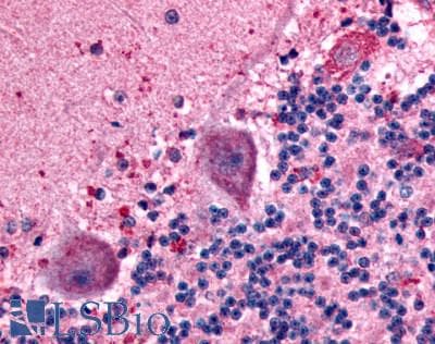IHC-plus™ ADGRB1 / BAI1 Antibody (C-Terminus)