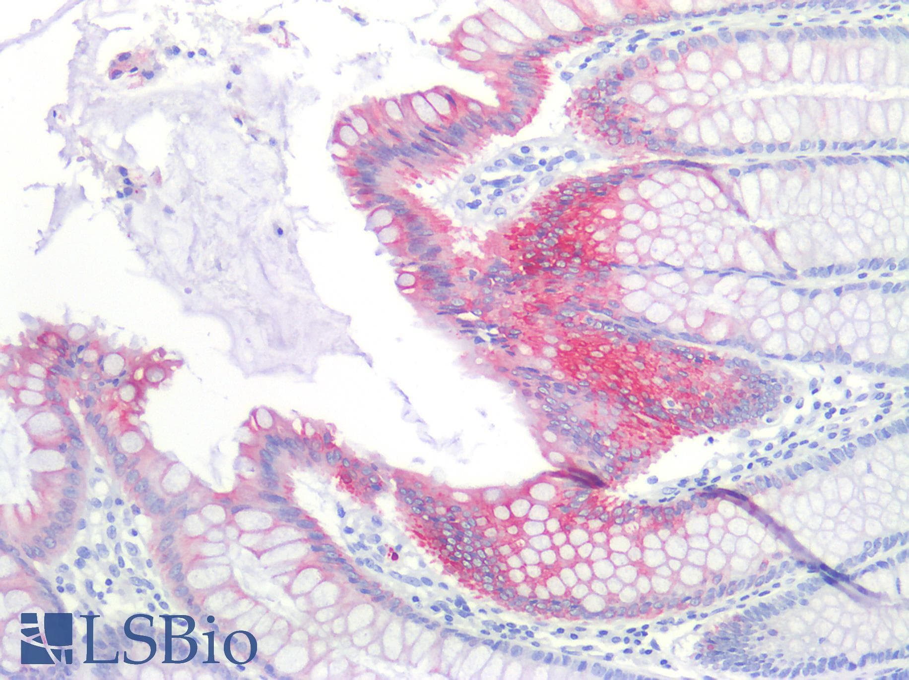IHC-plus™ KRT20 / CK20 / Cytokeratin 20 Antibody (clone KS 20.8)