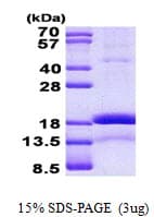 Human CHRAC1 Protein (Recombinant His)