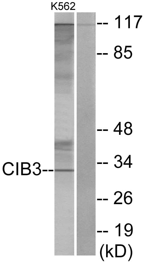 CIB3 Antibody (aa138-187)