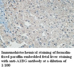 A1BG Antibody