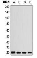Polyclonal Rabbit anti-Human CABP5 Antibody (N-Terminus, WB)