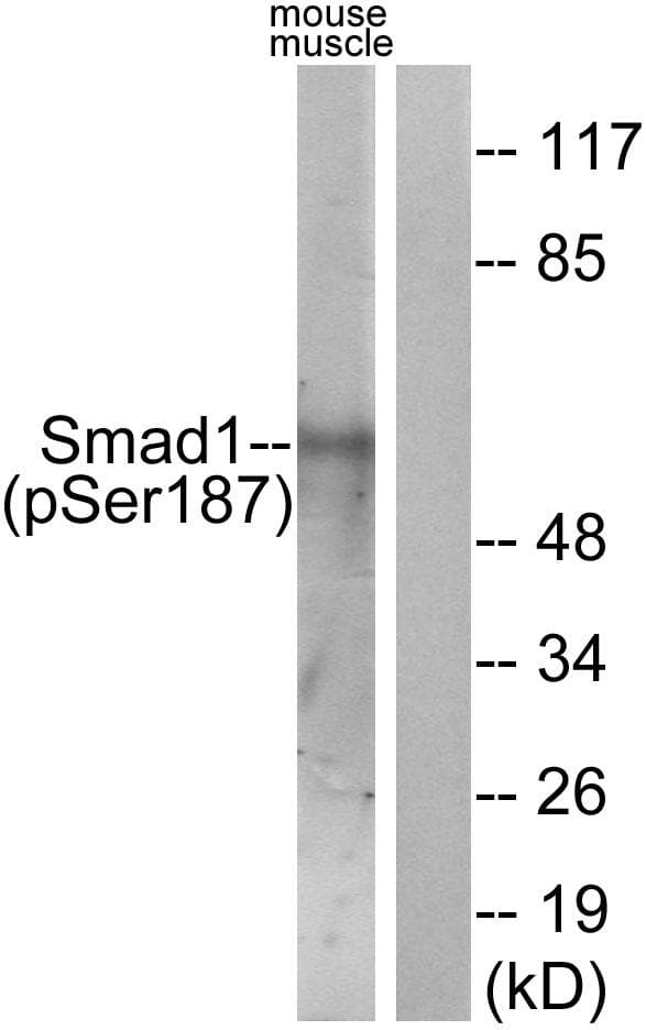 Polyclonal Rabbit anti-Human SMAD1 Antibody (phospho-Ser187, IHC, WB)