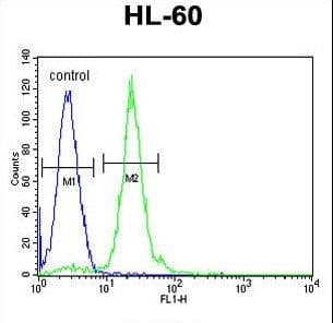 IHC-plus™ Polyclonal Rabbit anti-Human CPT1C Antibody (aa752-782, IHC, WB)