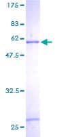 Human SULT1C2 / Sulfotransferase 1C2 Protein (Recombinant GST)