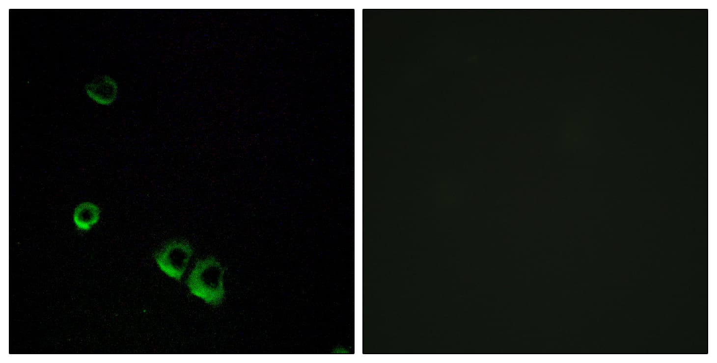 AVPR2 / V2R Antibody (aa72-121)