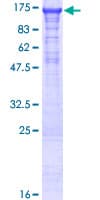 Human EFTUD2 Protein (Recombinant GST)