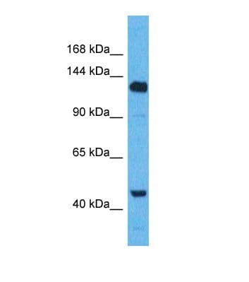 Polyclonal Rabbit anti-Human WWC2 Antibody (aa1144-1193, WB)