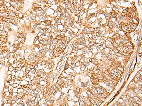NR0B2 Antibody