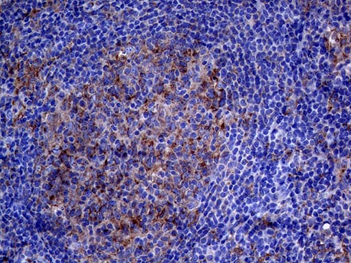 CLTA / LCA Antibody (clone OTI2F7)