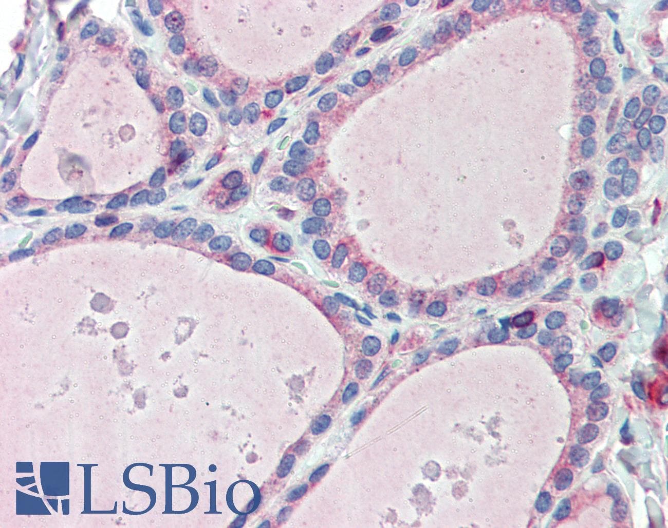 IHC-plus™ Polyclonal Rabbit anti-Human ESYT1 Antibody (C-Terminus, IHC)